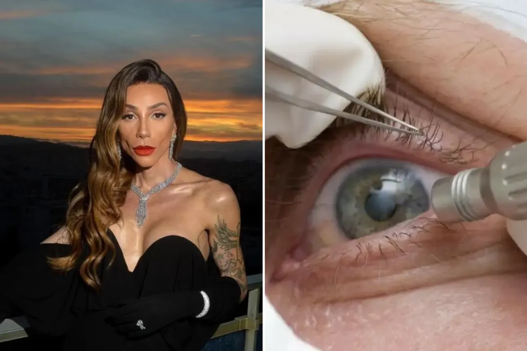 Maya Massafera muda cor dos olhos e médica alerta para risco de cegueira
